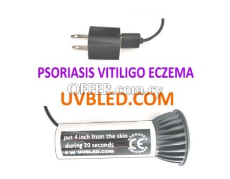 Psoriasis Vitiligo Eczema Light Therapy Lamp